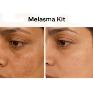 Melasma Kit