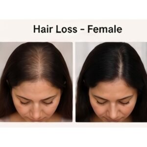 Hair Loss Kit