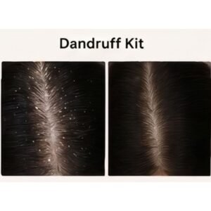 Dandruff Kit