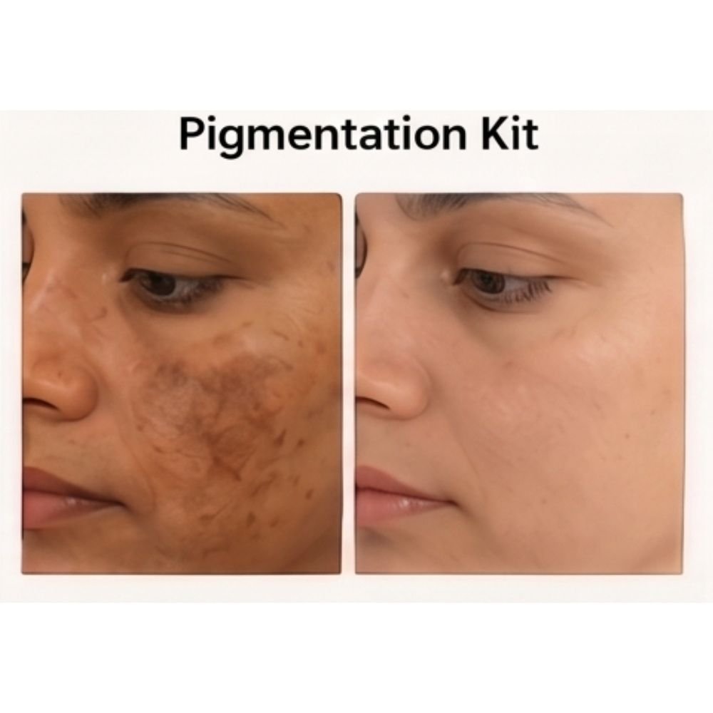Pigmentation Kit