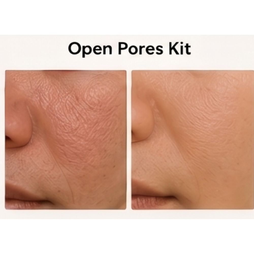 Open Pores Kit