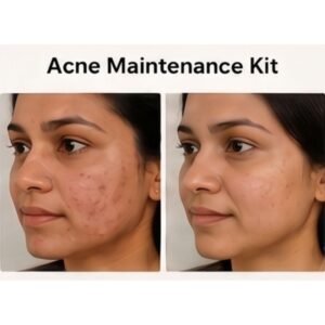 Acne Maintenance Kit